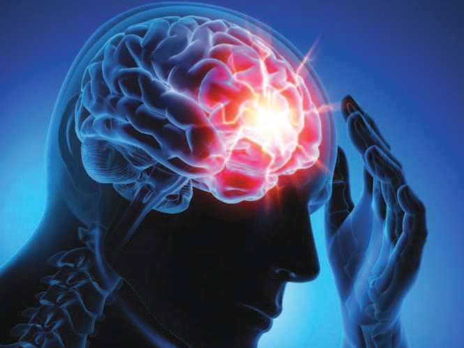 طريقة مبتكرة لعلاج الصرع بالجراحة