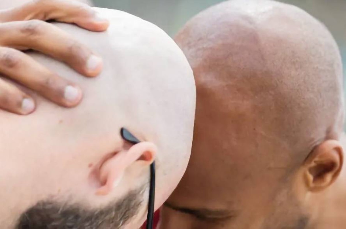 أدوية الصلع «منجم ذهب» وول ستريت